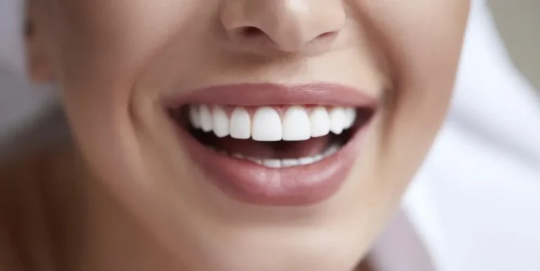 Hashtag Dentist Explains: Why Porcelain Veneers Are the Secret to a Celebrity Smile