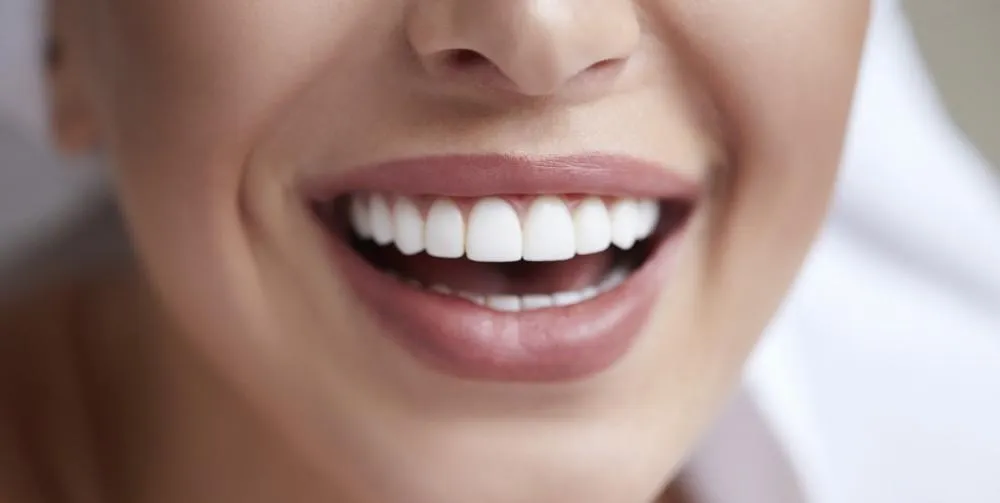 Hashtag Dentist Explains: Why Porcelain Veneers Are the Secret to a Celebrity Smile